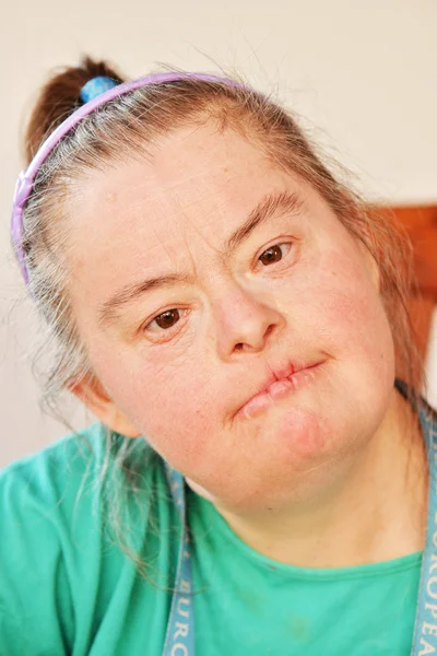 Kvinna med Downs syndrom — Stockfoto