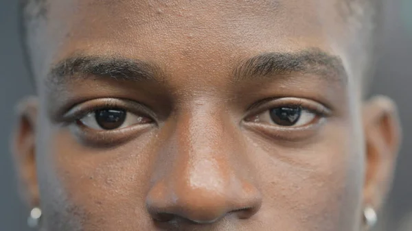 Les yeux clignotants du jeune homme africain — Photo