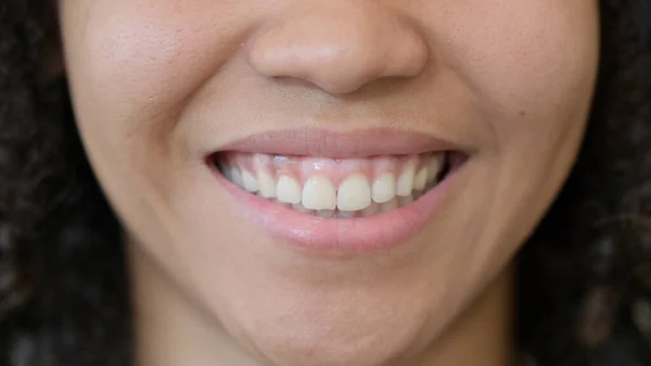 Close-up van glimlachende lippen van Afrikaanse vrouw — Stockfoto