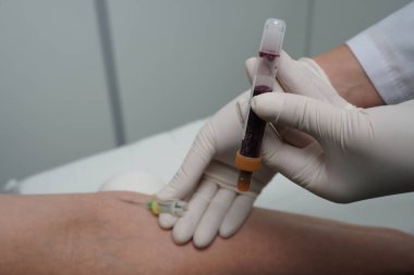 Aspirasyon sistemi kullanarak manikin damarından kan almak.