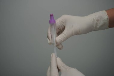 Manken kolundaki damarın delinmesi.