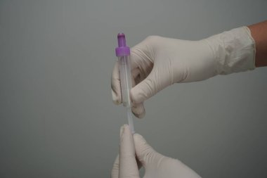 Manken kolundaki damarın delinmesi.