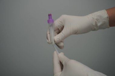 Manken kolundaki damarın delinmesi.