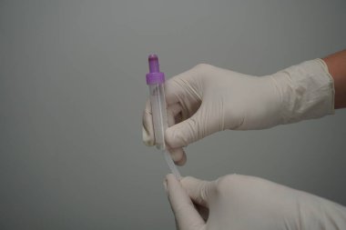 Manken kolundaki damarın delinmesi.