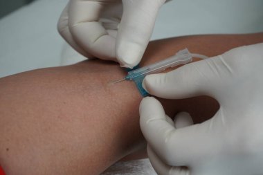 Vakum aspirasyon sistemi kullanarak sahte bir damardan kan almak.