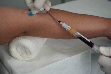 Vakum aspirasyon sistemi kullanarak sahte bir damardan kan almak.