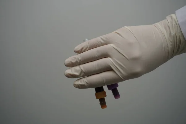 튜브를 사용하여 마네킹의 손에서 혈액을 채취하는 — 스톡 사진