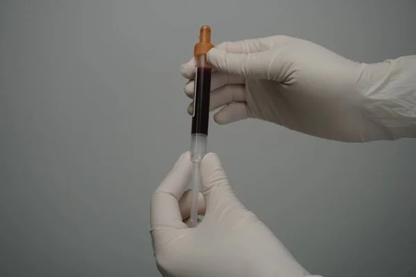 Tomar Sangre Venosa Mano Maniquí Usando Tubo Vacío — Foto de Stock