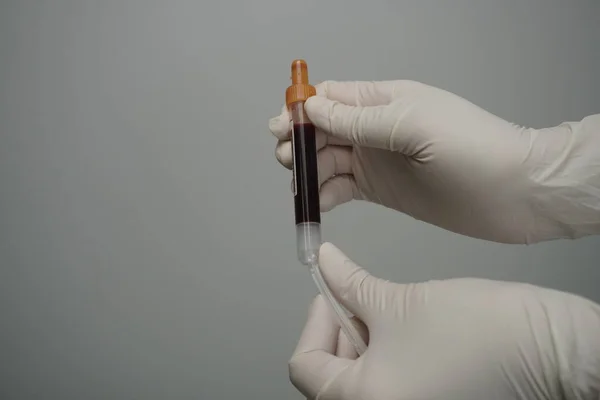 Tomar Sangre Venosa Mano Maniquí Usando Tubo Vacío —  Fotos de Stock