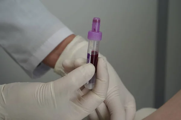 Taking Venous Blood Hand Mannequin Using Vacuum Tube — Stock Photo, Image