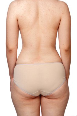 Bej külotlu genç bir kadın. Dikiz aynası. Selülit ve kilolu kalçalar. Beyaz izole bir arka planda. Tıp ve kozmetoloji kavramı.