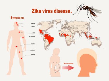 Zika virüs belirtileri infographics harita ile