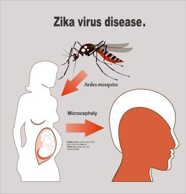 Anormal küçüklük kafa kavramı