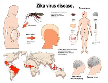Zika virüs belirtileri infographics harita ile