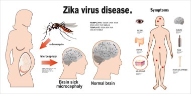 Zika virüs belirtileri