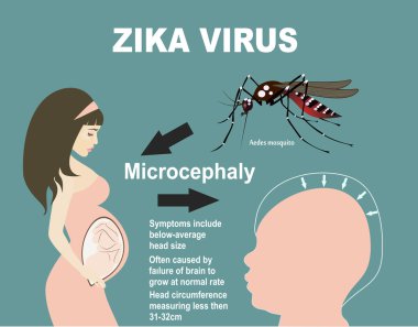 Anormal küçüklük kafa kavramı