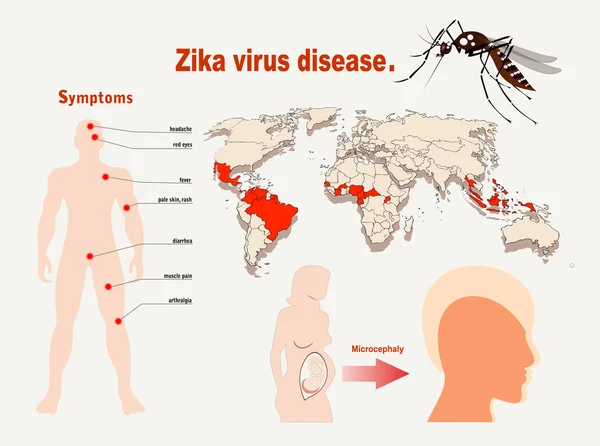 Infografías de los síntomas del virus del Zika con mapa — Vector de stock