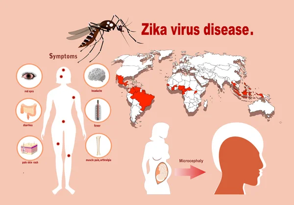 Zika wirusa objawy infografiki z mapą — Wektor stockowy