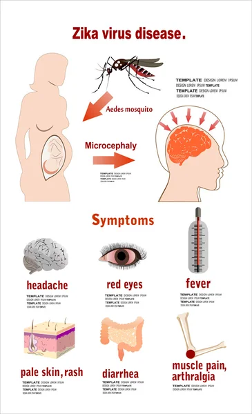 Zika viruset symtom — Stock vektor