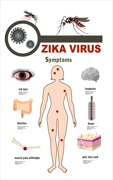 Zika vírus sintomas infográficos — Vetor de Stock