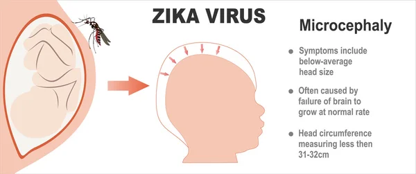 Menoridade anormal do conceito de cabeça — Vetor de Stock