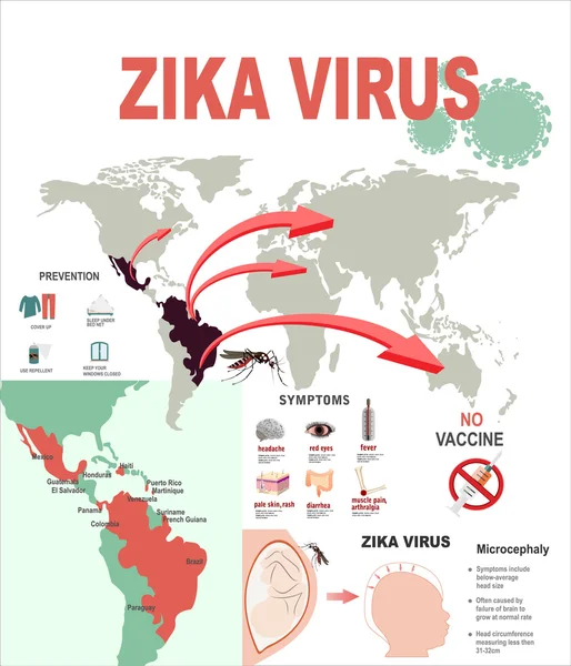 Infografías de los síntomas del virus del Zika con mapa — Vector de stock