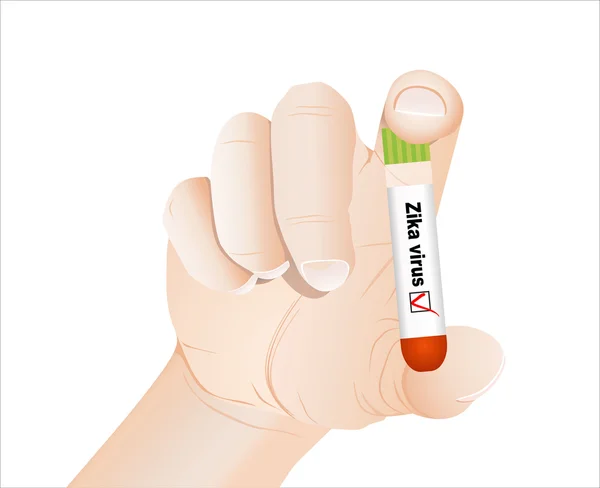 혈액 샘플 Zika 바이러스와 긍정적인 — 스톡 벡터