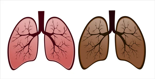 Pulmão do fumante versus pulmão saudável — Vetor de Stock