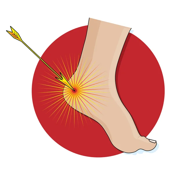 Aquiles Calcanhar sinal — Vetor de Stock