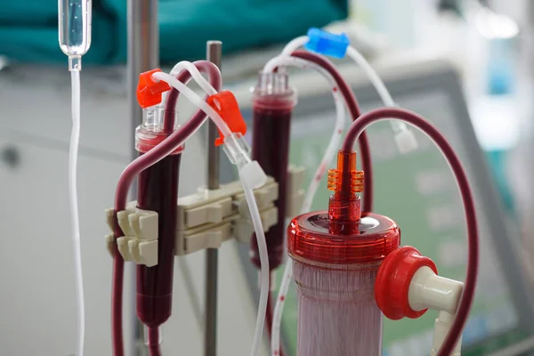 集中治療室における腎不全の血液透析装置のクローズアップビュー — ストック写真