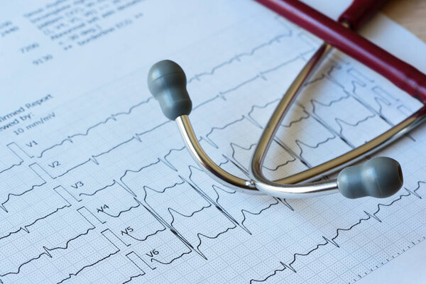 Крупный план красного стетоскопа на бумажном фоне ЭКГ