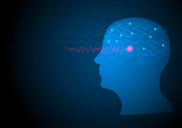 Ohniskový Záchvat Vektorová Ilustrace Lidského Mozku Elektroencefalografie Nebo Eeg Spánkového — Stockový vektor