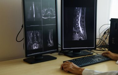 Doktor bilgisayar monitöründe omurga MR 'ına bakıyor.