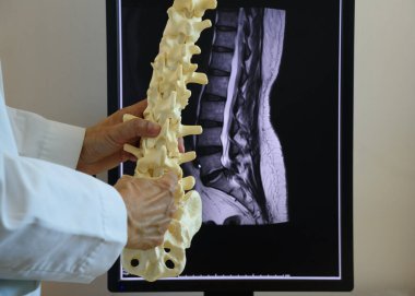 Doktor omurga modelini MRI bilgisayar ekranının önünde tutuyor.