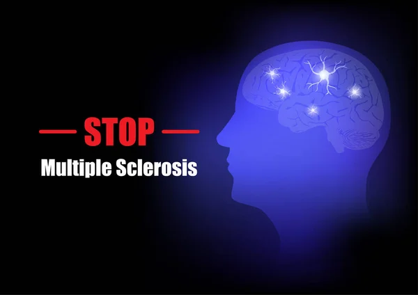 Campaña Del Día Mundial Del Cerebro 2021 Concepto Detener Esclerosis — Vector de stock