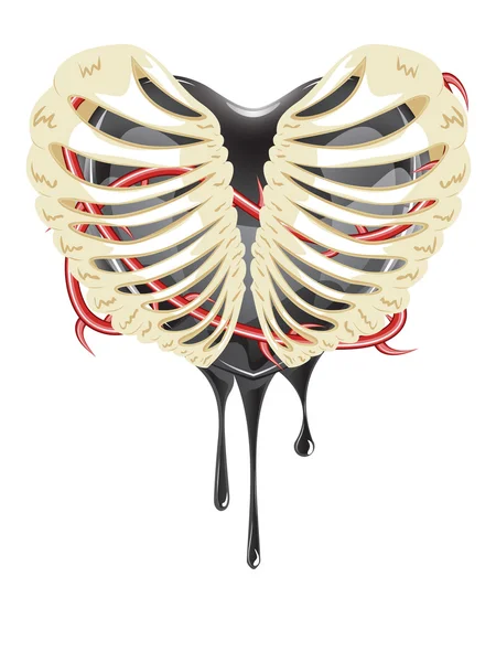 Zwarte breuk in Thorax — Stockvector