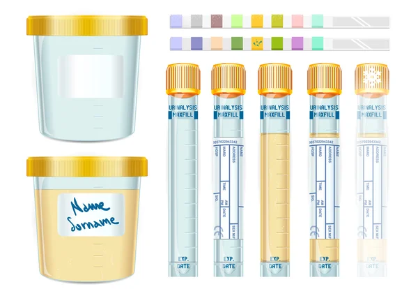 мочу постепенно. моча напиток. хилурия моча. моча. Glycosuria.