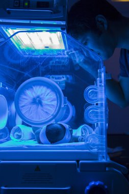 Yeni doğan bebek sarılık UVB Fototerapi tedavisi sahip