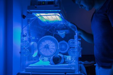Yeni doğan bebek sarılık UVB Fototerapi tedavisi sahip