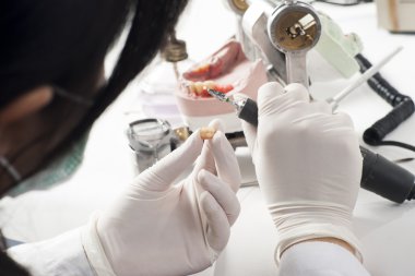 Diş teknisyeni articulator ile çalışma