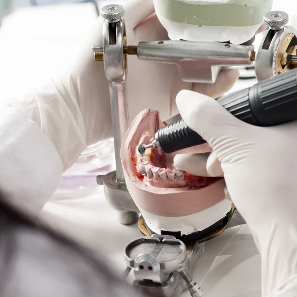 Técnico dental que trabaja con articulador — Foto de Stock