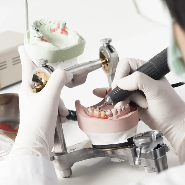 Técnico dental que trabaja con articulador — Foto de Stock