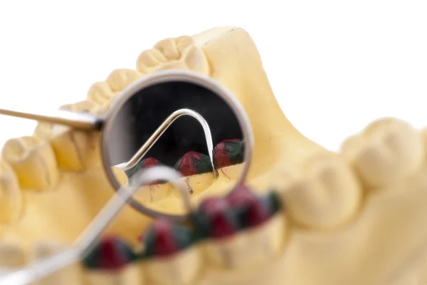 Modelo de molde de prótesis y herramientas dentales —  Fotos de Stock