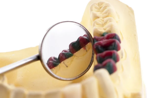Modelo de molde de dentadura e ferramentas odontológicas — Fotografia de Stock
