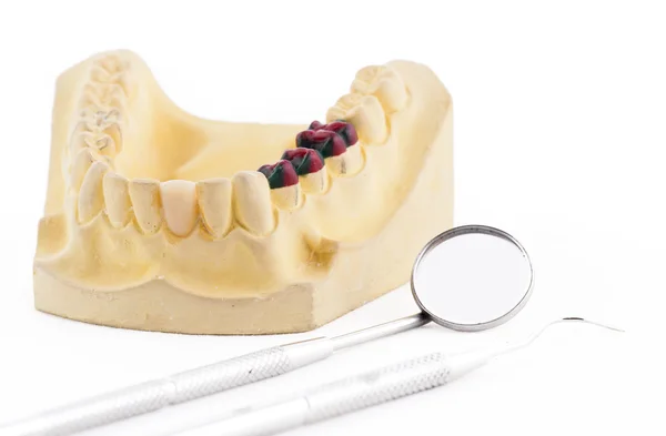 Denture cast model and dental tools — Stock Photo, Image