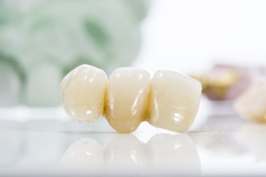 Protez dişler beyaz bir arka plan üzerinde makro