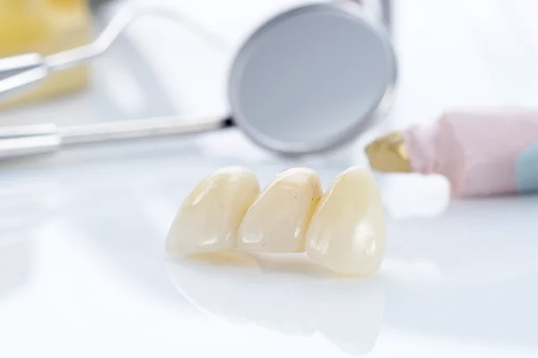 Macro of prosthetic teeth with dental tools — Stock Photo, Image