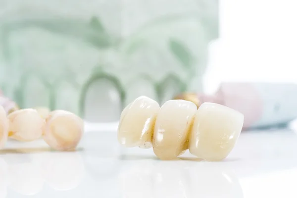 Makro protetiska tänder på en vit bakgrund — Stockfoto