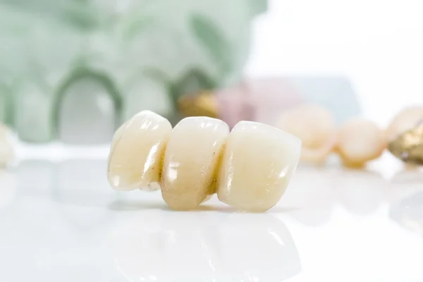 Macro of prosthetic teeth on a white background — Stock Photo, Image