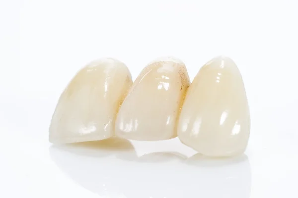 Macro de dentes protéticos em um fundo branco — Fotografia de Stock